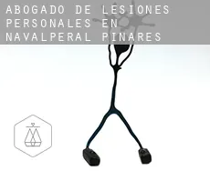 Abogado de lesiones personales en  Navalperal de Pinares